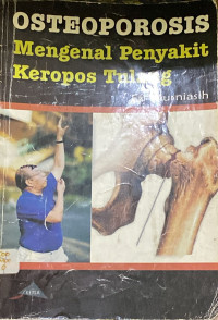 Image of Osteoporosis (Mengenal Penyakit Keropos Tulang)